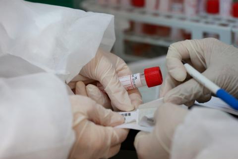 وزارة الصحة: انتهاء أزمة نقص مواد فحص فيروس كورونا